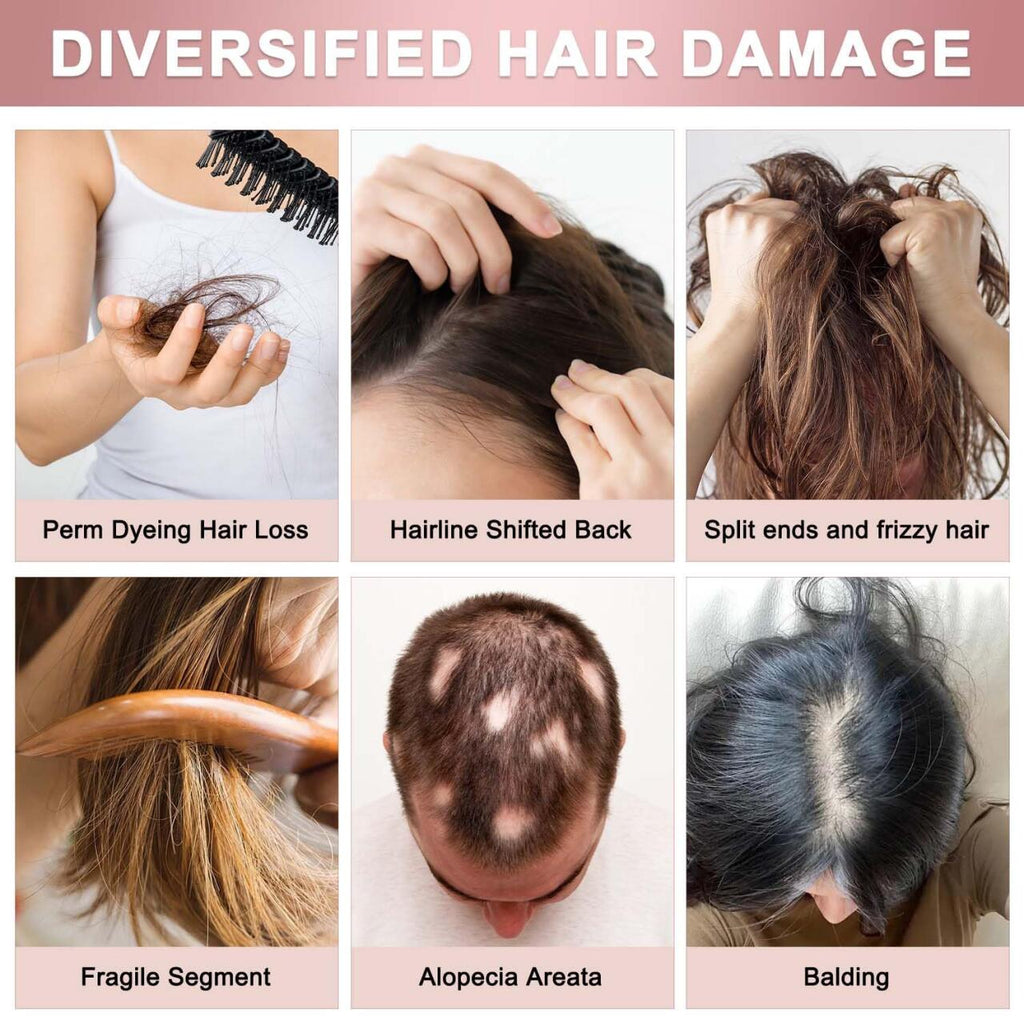 Sprays Para Favorecer el Crecimiento del Cabello y Mejorar la Salud del Cuero Cabelludo