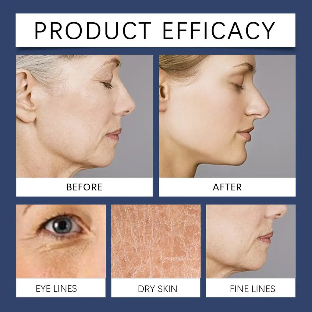 Hoygi Crema Reafirmante Antiarrugas con Péptidos – 50g ✨💆‍♀️