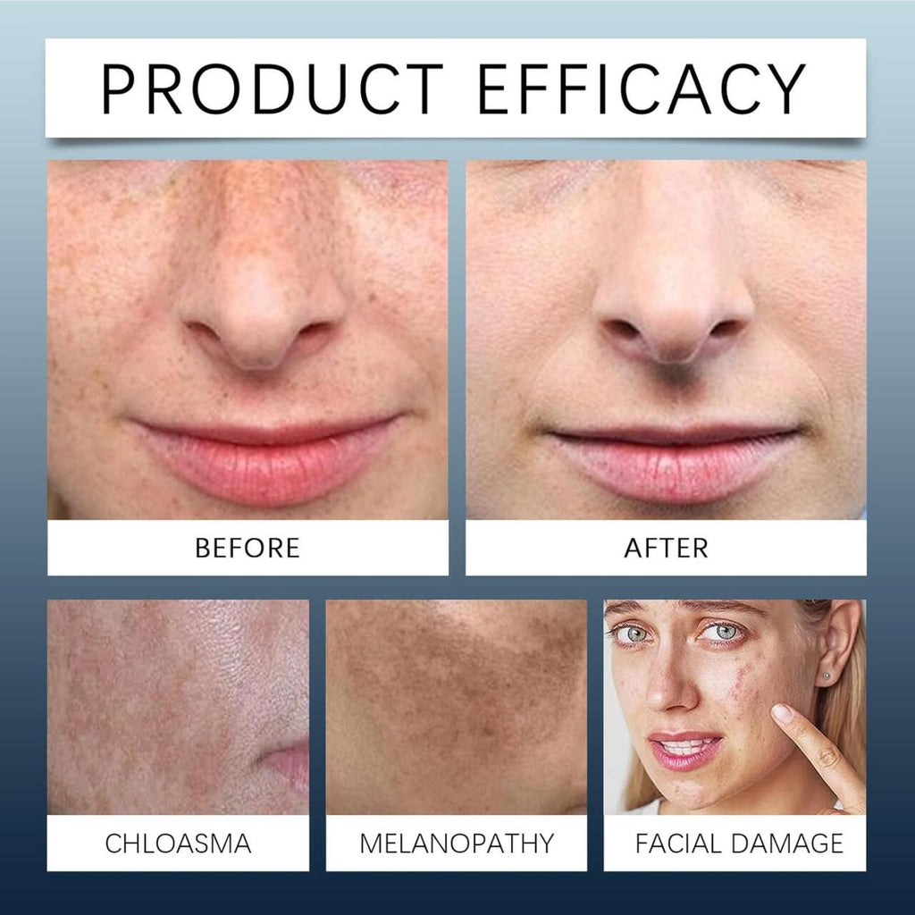 Kit Crema Hidratante de Día y Noche con Extracto de Centella Asiática 🌙☀️🌿